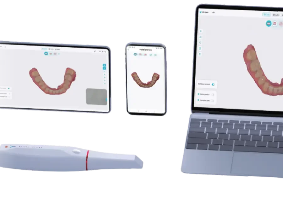 KP Scaner , Intra oral scanner, smile 2