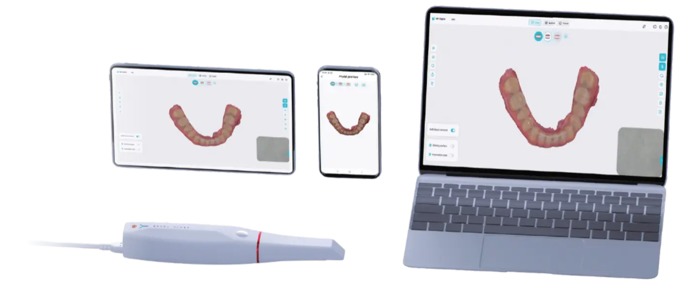 KP Scaner , Intra oral scanner, smile 2