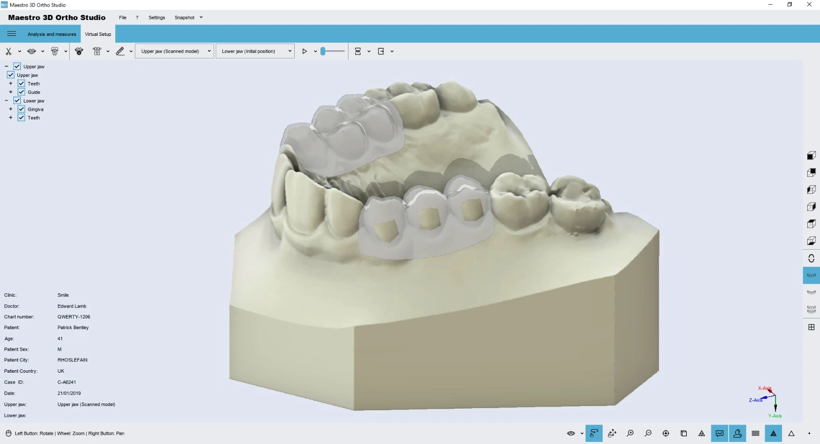Ortho studio Bite splint software