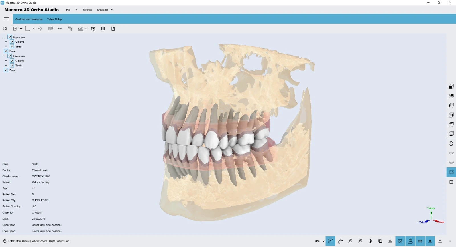 Ortho studio Smile creator software