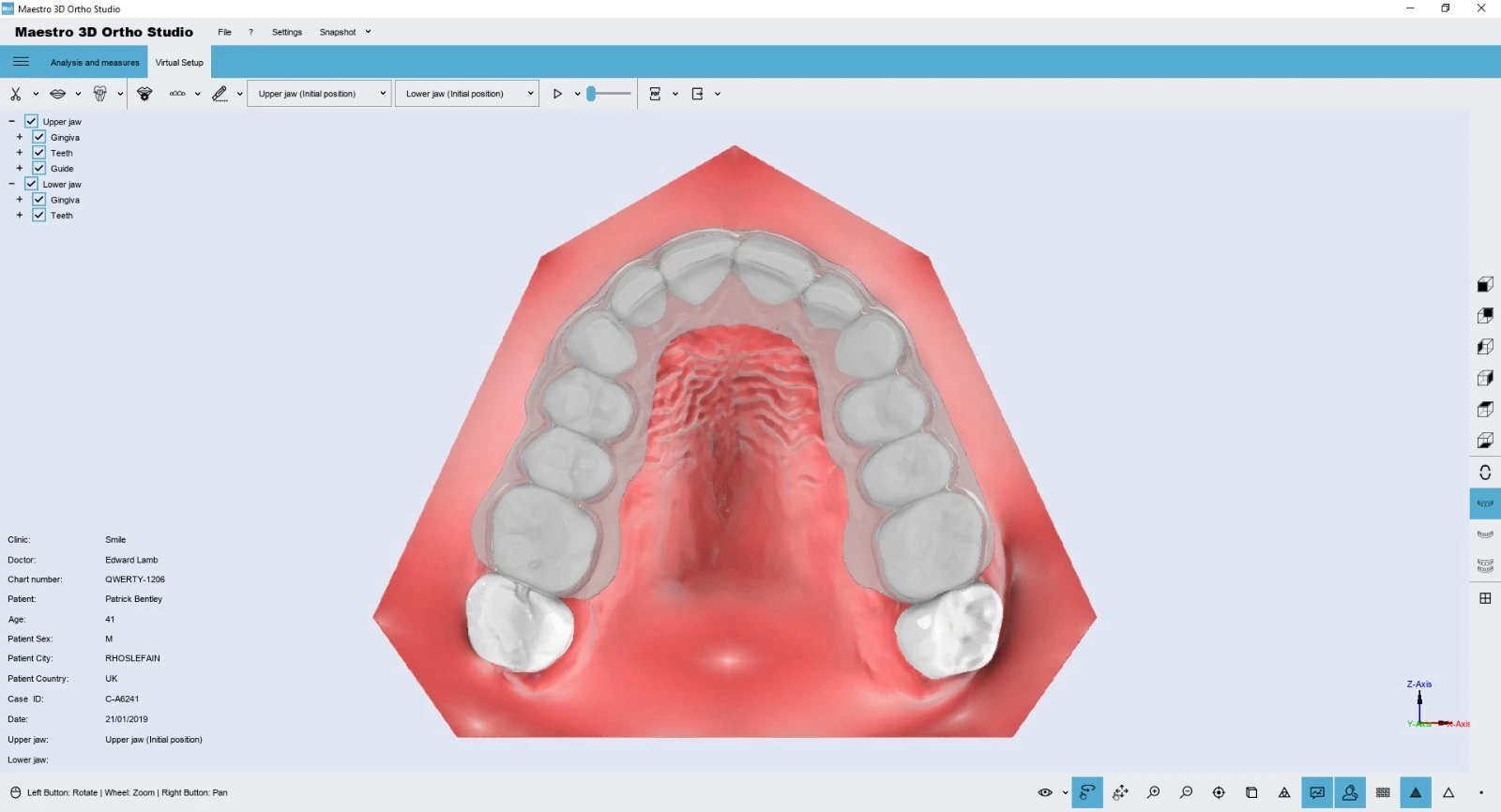 Ortho studio aligner trimming module
