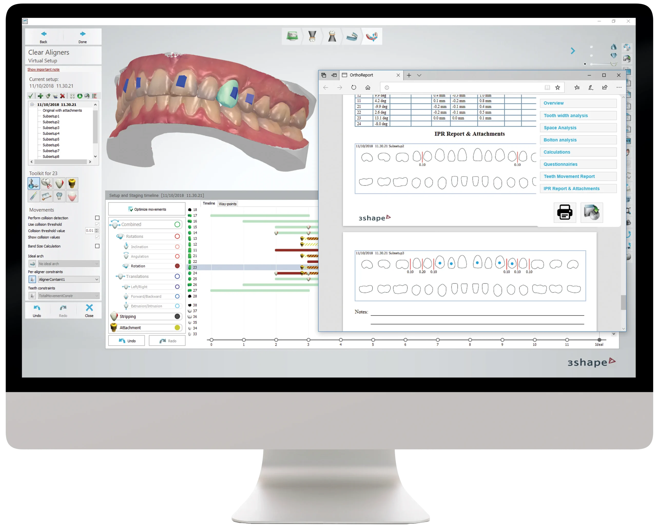 3Shape Clear Aligner Studio