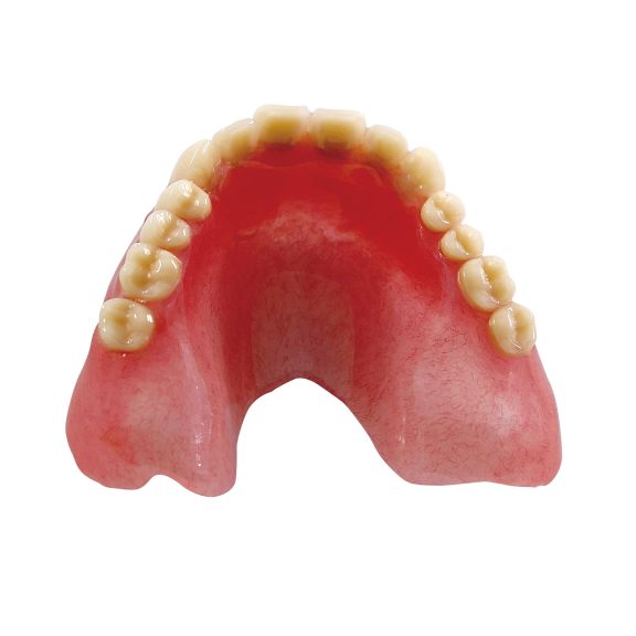 preview-Removable-Dental-Prostheses-Dry-DWX