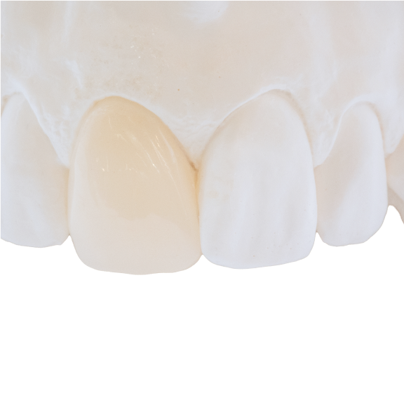 preview-Veneer-Dry-DWX