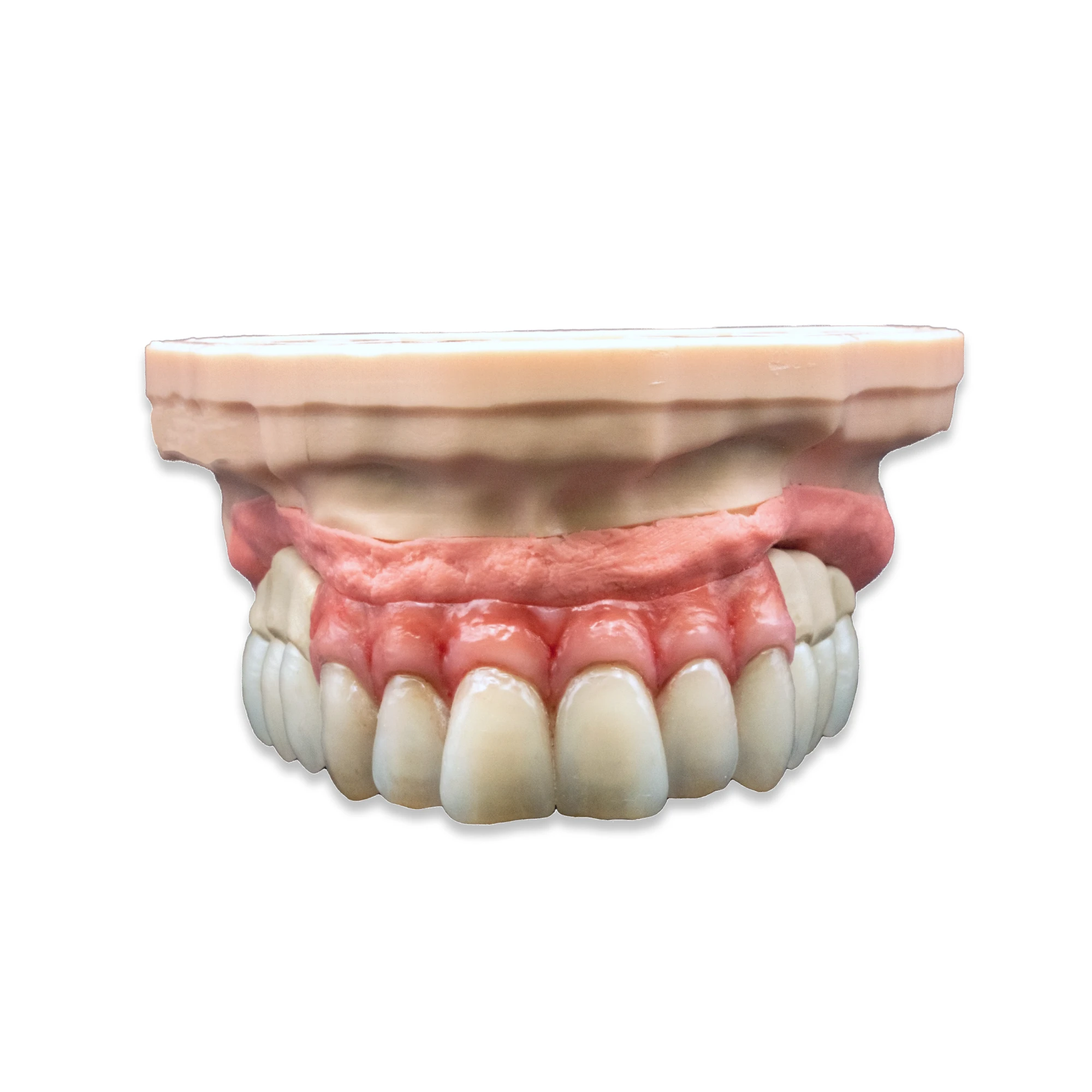 toronto_bridge_dental_laboratory