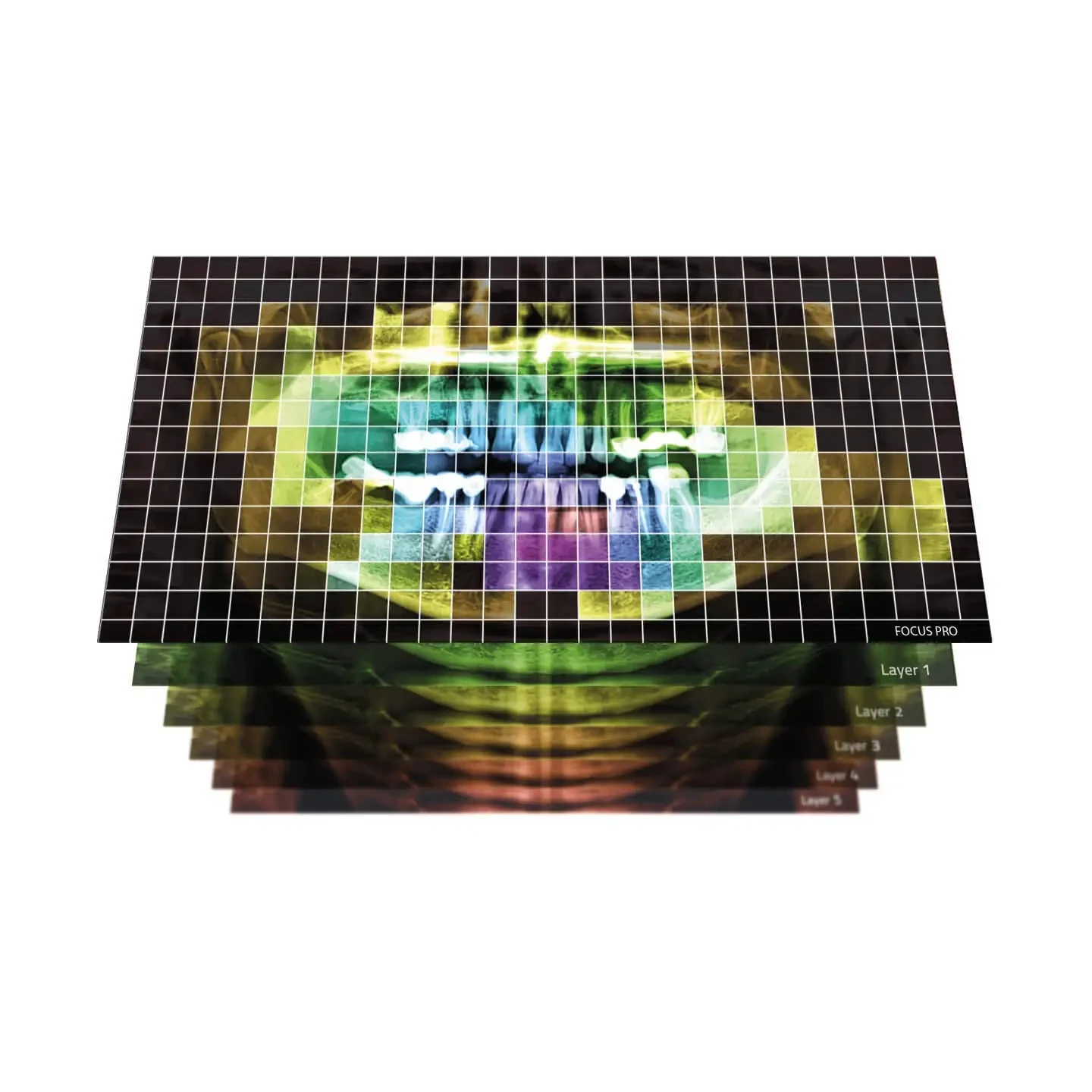 NewTom vg-one pictures