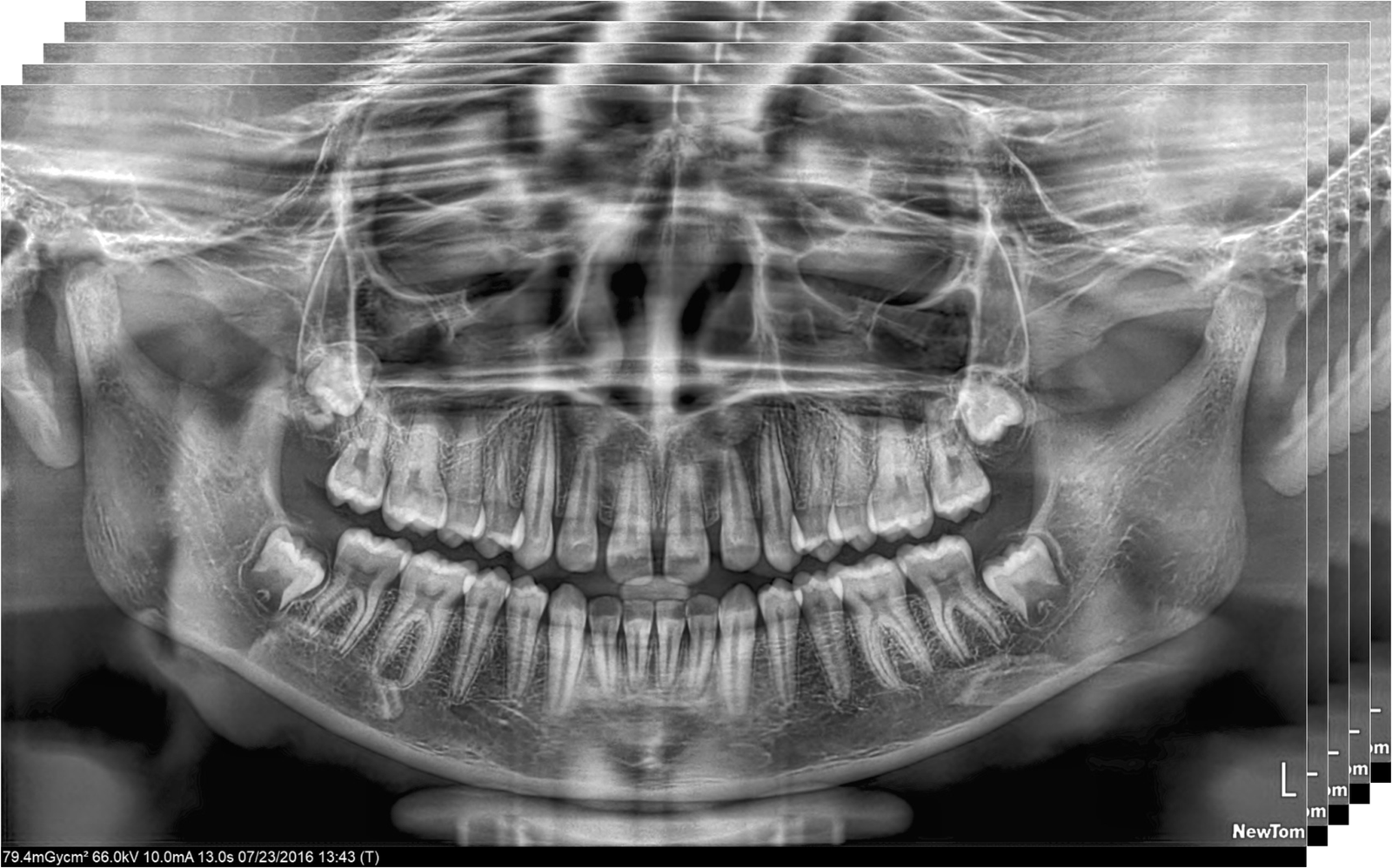 newtom multipan imaging