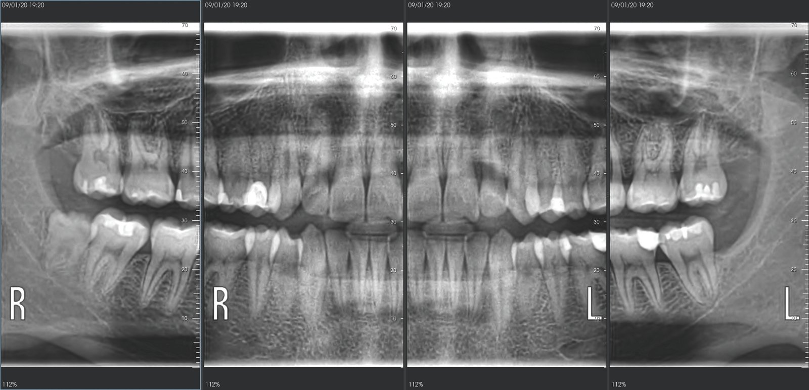 best cbct