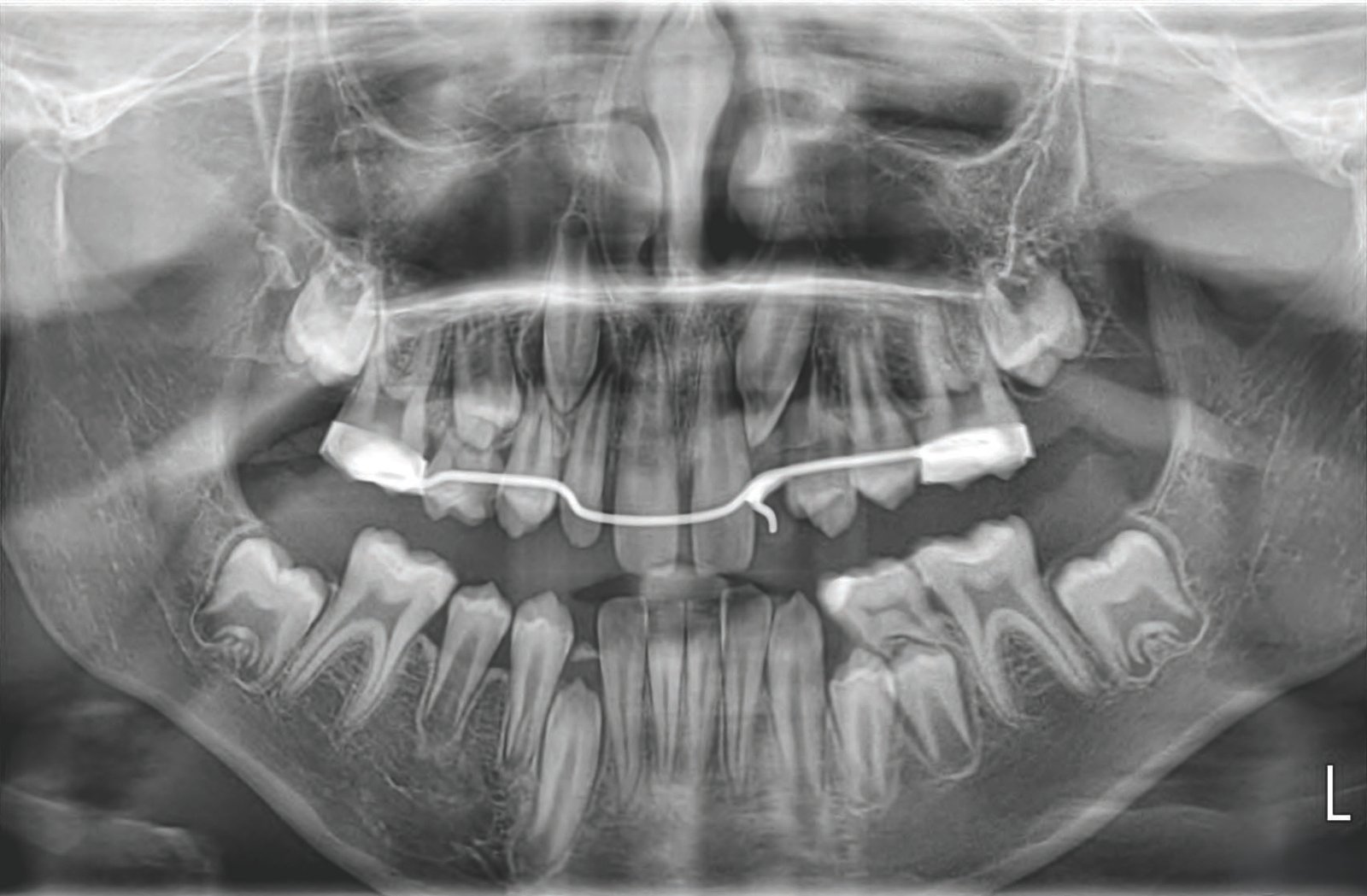 best cbct in indi