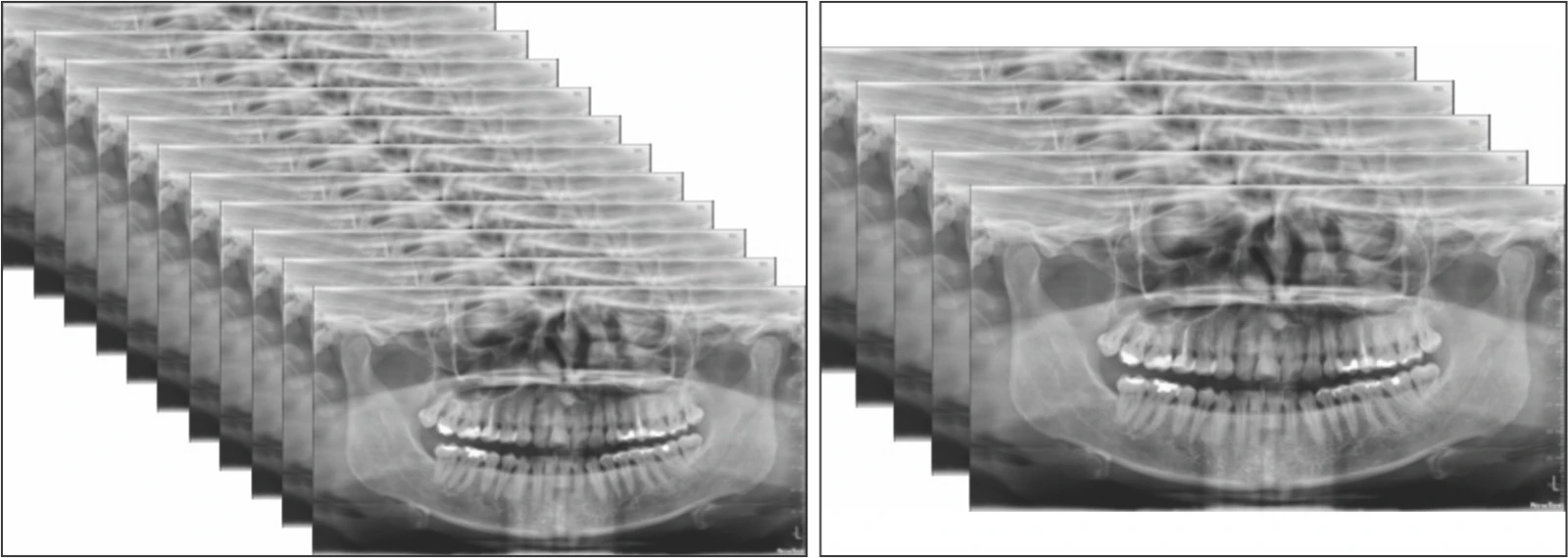 best cbct machine -newtom cbct machine