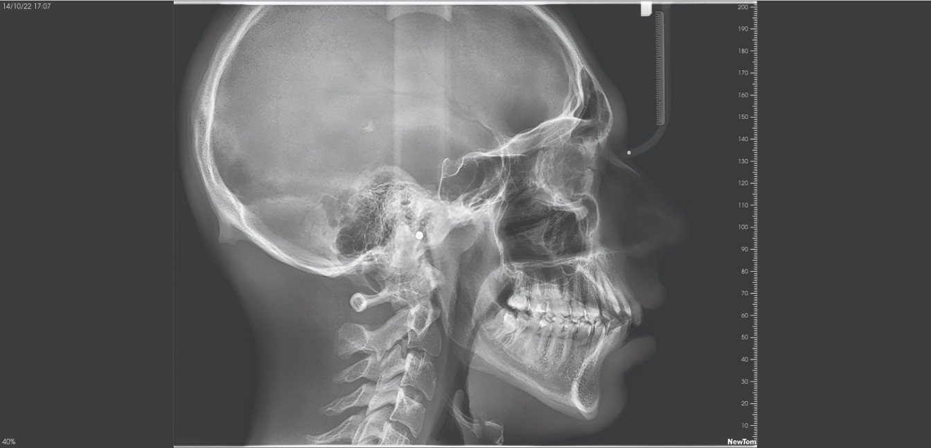 best cbct machine scan