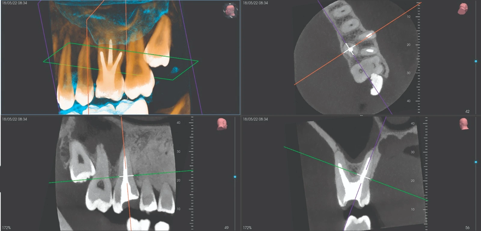 best cbct machine scan