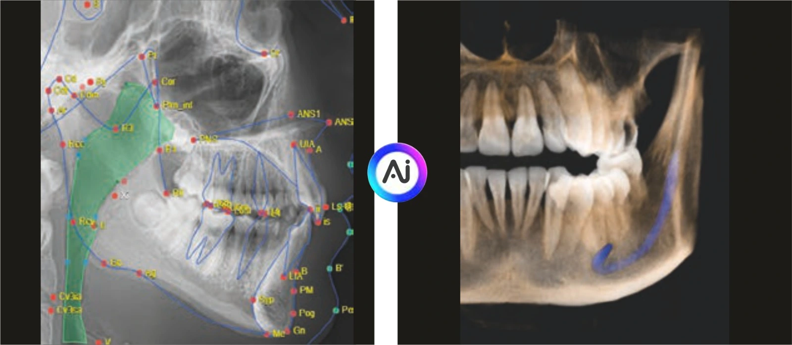 cbct machine in india price
