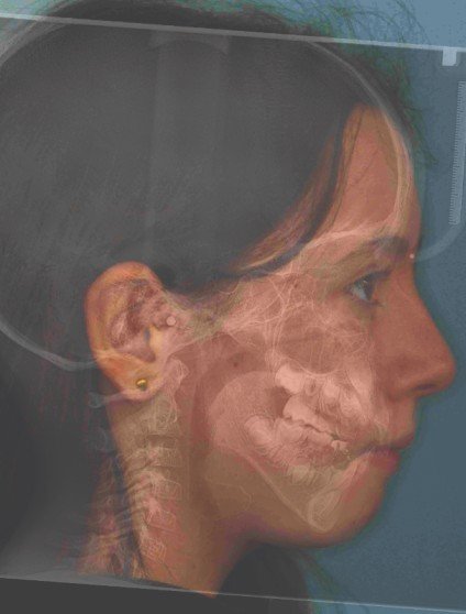 cbct machine scan