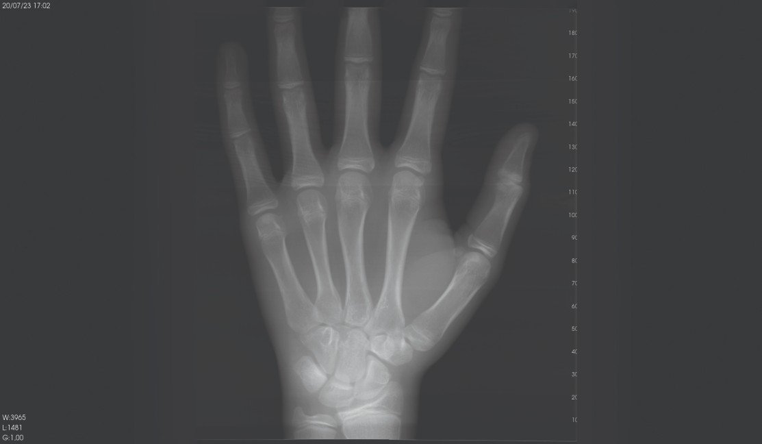 cbct machine scan result