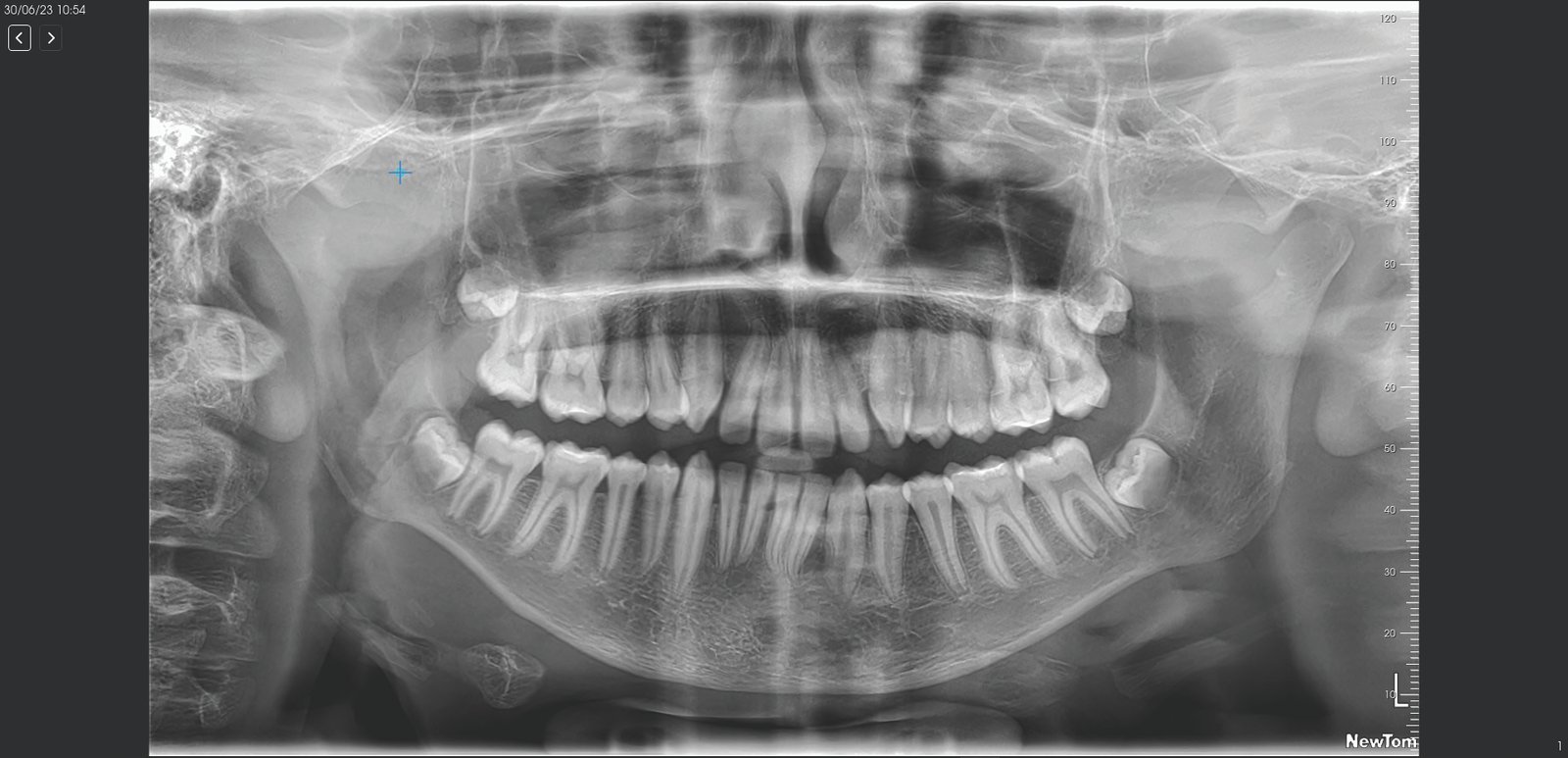 cbct machine scan