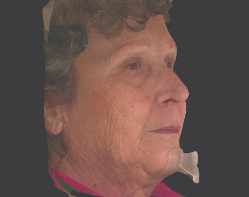 cbct scan from best cbct machine