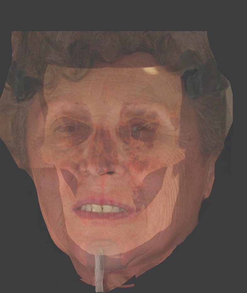cbct scan from newtom