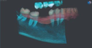 cbct scan machine