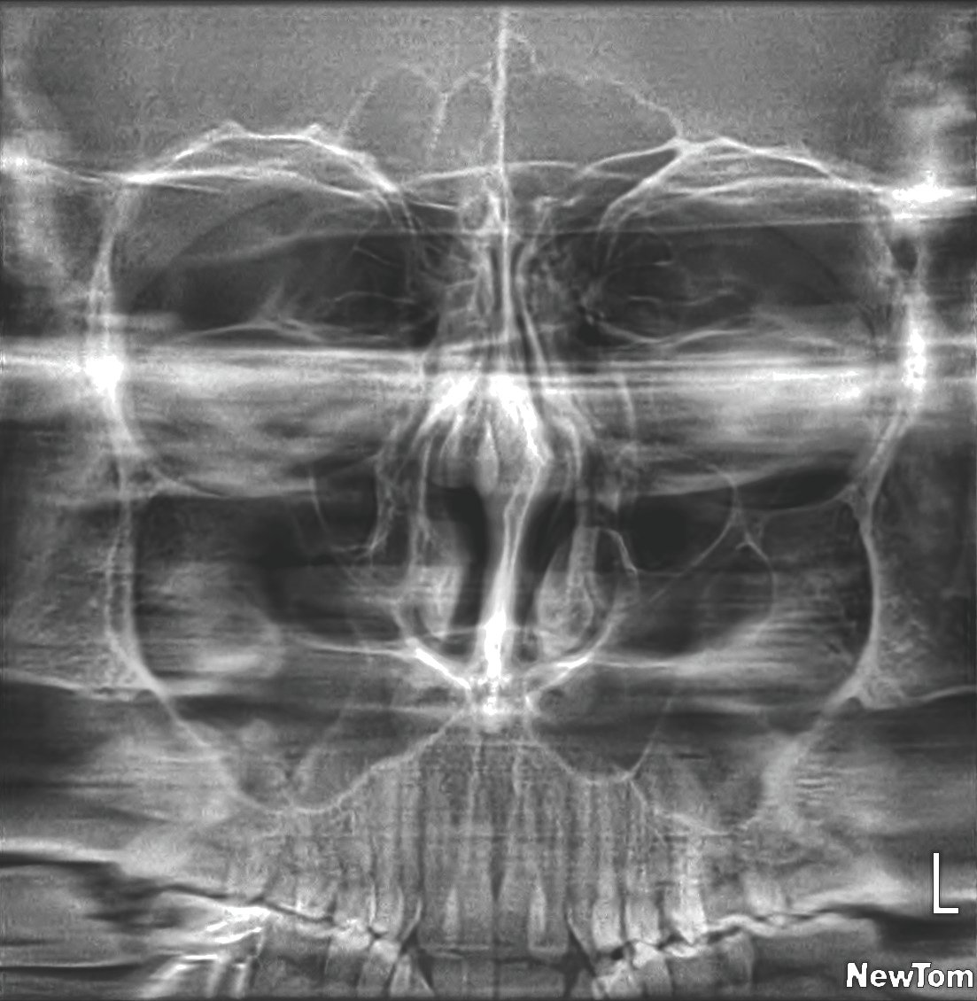 dental cbct scanner