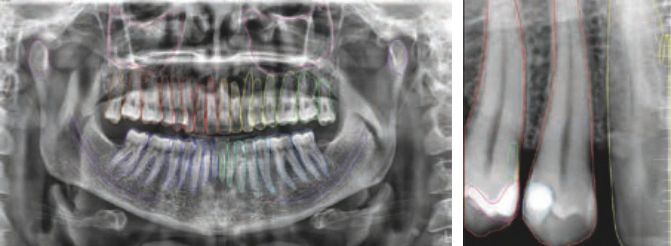 dental cbct machine scan