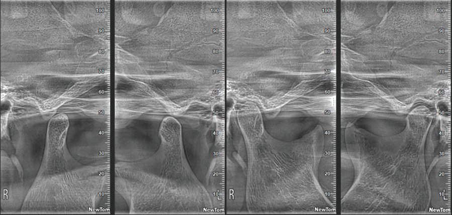dental cbct scanner