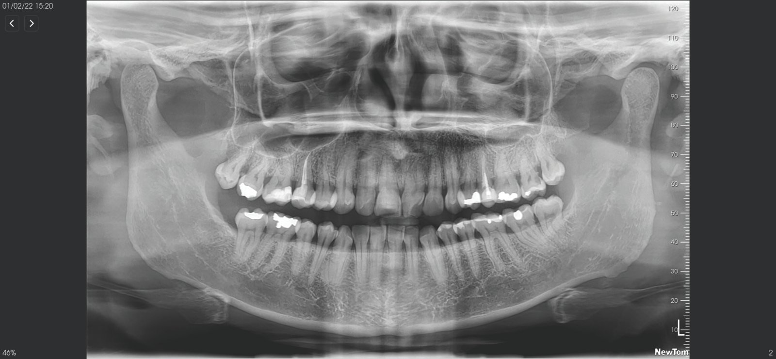 newtom c bct giano HR best scan